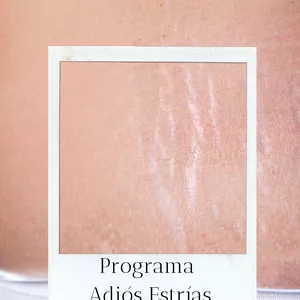 Imagen de portada para Curso online Programa Adiós Estrías
