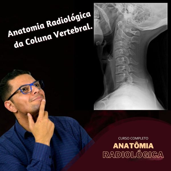 Anatomia Radiologica Da Coluna Vertebral Rodrigo Da Silva Lima Learn A New Skill Online Courses And Subscription Services Hotmart