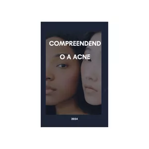 Cover image for Ebook Compreendendo a acne