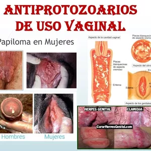 Imagen de portada para Ebook FÁRMACOS-PDF (Antiprotozoarios Vaginales y Antisepticos) Enfermeria-2024