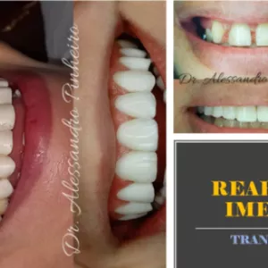 Imagem de CURSO DE REABILITAÇÃO ORAL IMEDIATA/MEDIATA - ESTÉTICA E FUNCIONAL. criado por Alessandro Pará Pinheiro na hotmart