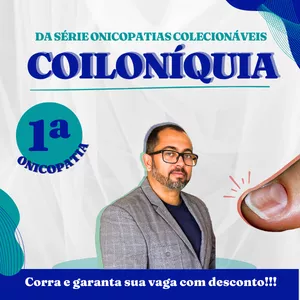 Imagem de capa para o Curso online 01 - Coiloníquia - Onicopatias Colecionáveis
