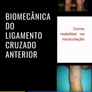 Imagem de capa para o Curso online BIOMECÂNICA DO LIGAMENTO CRUZADO ANTERIOR: COMO REABILITAR NA MUSCULAÇÃO