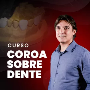 Imagem de capa para o Curso online Curso Coroa sobre dente