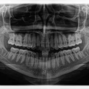 Imagem de capa para o Ebook Resumo TSB
