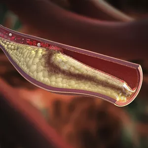 Imagem de capa para o Ebook A estratégia do colesterol oxidado