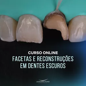 Imagem de capa para o Curso online Curso Online Facetas e Reconstruções em Dentes Escuros