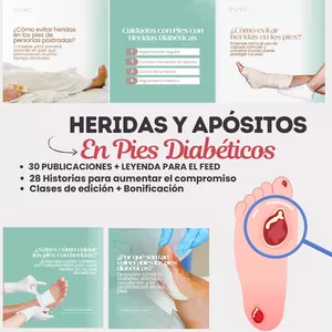 Imagen de portada para Curso online PACK HERIDAS Y APÓSITOS EN PIES DIABÉTICOS