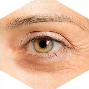 Imagem do curso COMO PREVENIR AS RUGAS