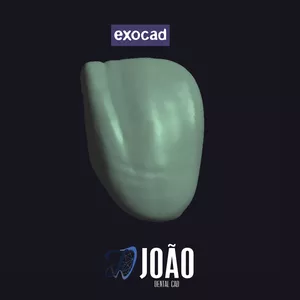 Imagem de capa para o Curso online Inicie como Dental Designer - ExoCAD JoãoDentalCAD 