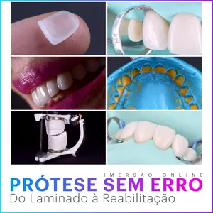 Imagem de capa para o Curso online Prótese Sem Erro