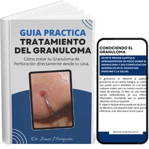 Imagen de portada para Ebook Guía práctica para el tratamiento del granuloma