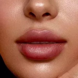 Cover image for Ebook Premium Lip Filler Course