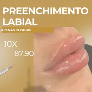 Imagem de capa para o Ebook PREENCHIMENTO LABIAL  10X87,90