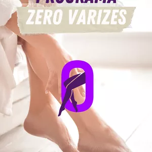 Imagem de capa para o Curso online Programa Zero Varizes