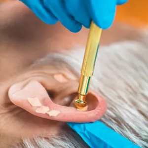 Imagem de capa para o Evento presencial Formação individualizada em Auriculoterapia Clínica