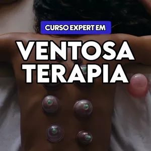 Imagem do curso Expert em Ventosaterapia 