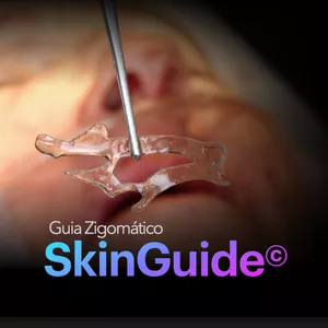 Imagem de capa para o Curso online SkinGuide - Guia para Implante Zigomático