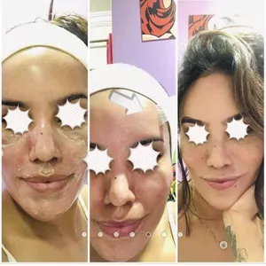 Imagem de capa para o Curso online PASSO A PASSO PEELING ÁCIDO RETINÓICO 10%