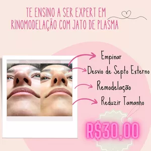 Imagem do curso Seja expert em rinomodelação com Jato de Plasma