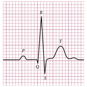 Imagem de capa para o Curso online O Eletrocardiograma na vida real - CURSO ECG.MED.BR