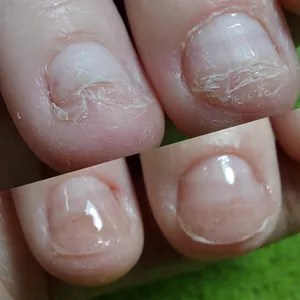 Imagem do curso Reconstrução de unhas roídas 