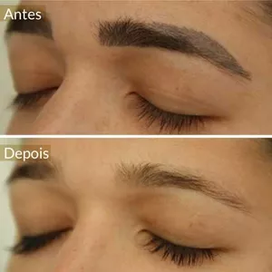 Curso Curso passo a passo de despigmentação química 2.1