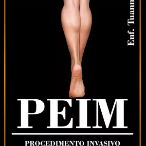 Imagem de capa para o Ebook EBOOK PEIM - Tratamento de Microvasos