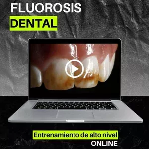 Imagen de portada para Curso online FLUOROSIS DENTAL
