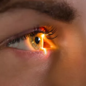 Imagem de capa para o Curso online Pós-graduação em Oftalmologia