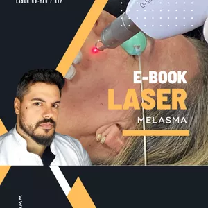 Imagem de capa para o Ebook E-book Despigmentação de MELASMA com Laser Nd-yag Q-Switch