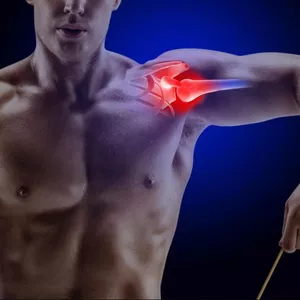 Imagem de capa para o Curso online Adeus Bursite de Ombro - Método ARM BALANCE