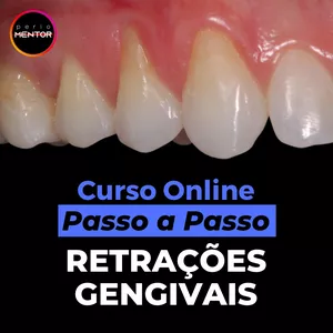 Imagem de capa para o Curso online Retrações Gengivais - Curso Passo a Passo Online