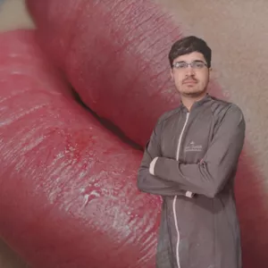 Microlabial Mudando Sua Vida