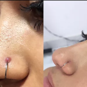 Imagem de capa para o Ebook Laserterapia Aplicada ao Piercing