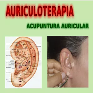 Imagem principal do produto Curso de Auriculoterapia e Acupuntura Auricular