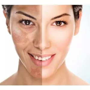 Imagem de capa para o Ebook SKIN CARE PELE PERFEITA EM UMA SEMANA