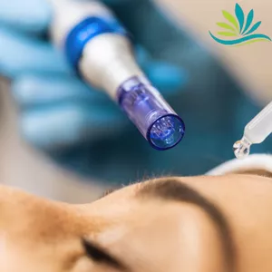 Imagem de capa para o Curso online Curso Microagulhamento Facial