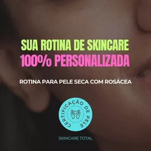 Imagem de capa para o Curso online Rotina de Pele SECA com ROSÁCEA Skincare Total