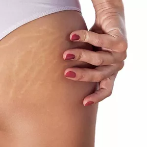 Imagem do curso Camuflagem Estética Reparadora