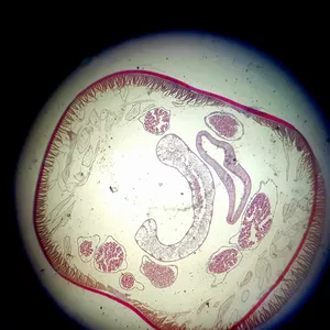 Imagem de capa para o Curso online Imagem Taenia Saginata (Tênia)