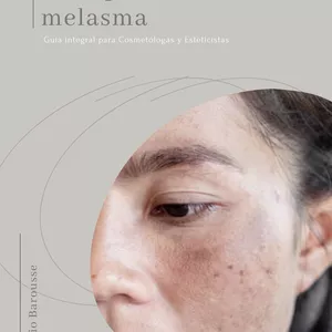 Imagen de portada para Ebook Mis apuntes sobre Melasma 