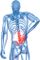 Chronic pain management
