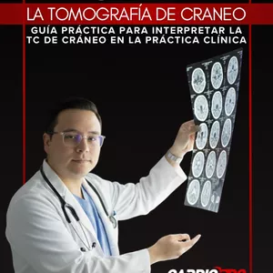Imagen de portada para Ebook DOMINA LA TOMOGRAFÍA DE CRANEO. 