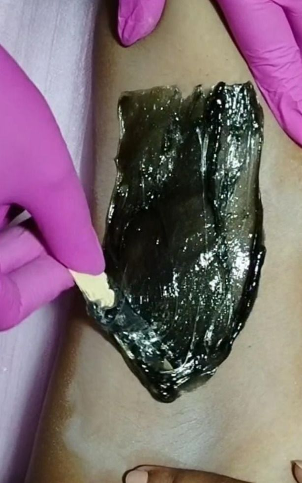 Depilação íntima e corporal avançado