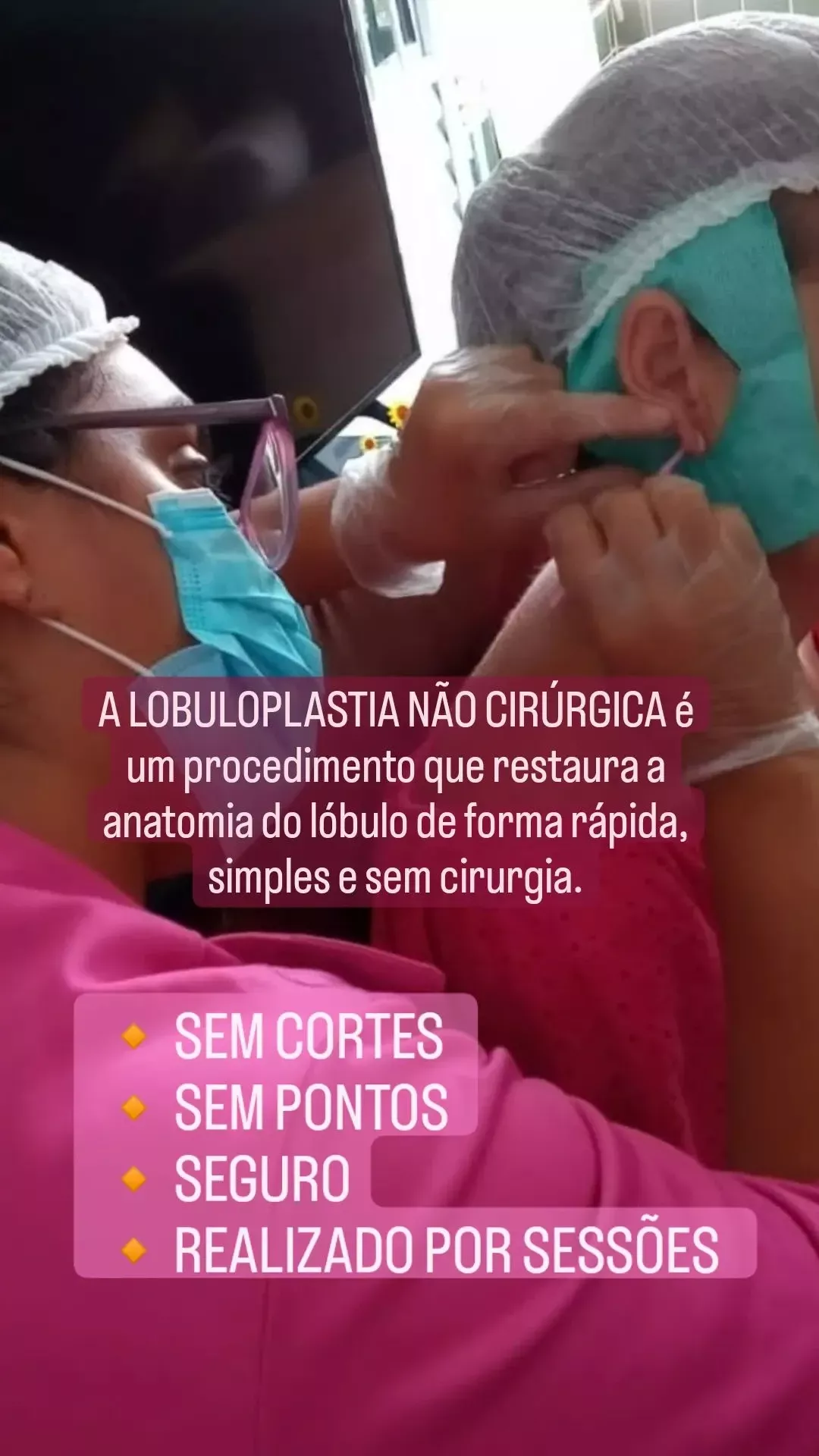 Curso de Lobuloplastia - Guia Completo para uma Reconstrução de Orelhas Rasgadas" — imagem 5