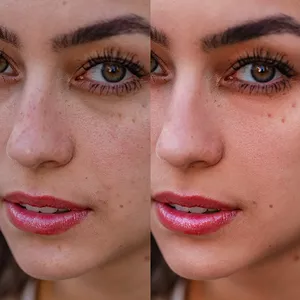 Imagem do curso TRATAMENTO DE PELE profissional usando separação de frequência no Photoshop