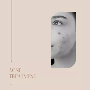 Imagen de portada para Ebook Lo que debes saber sobre el acne