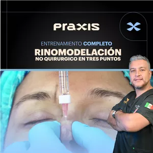 Imagen de portada para Curso online Rinomodelación no quirúrgica en tres puntos
