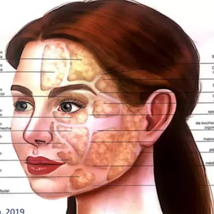 Imagem de capa para o Curso online Emptiers- Esvaziamento de Celulas de Gordura - Facial